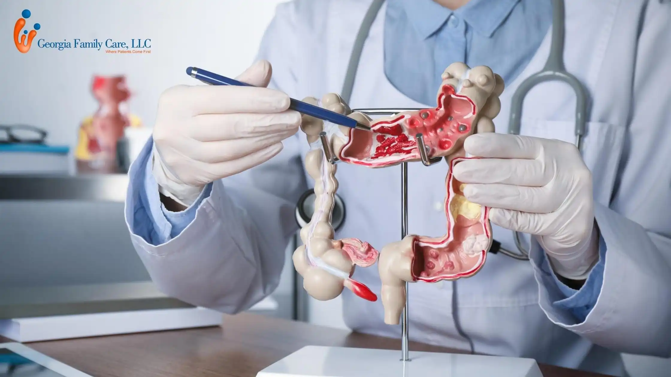 Doctor demonstrating colon cancer and polyps using a 3D colon model during a screening consultation at Georgia Family Care.
