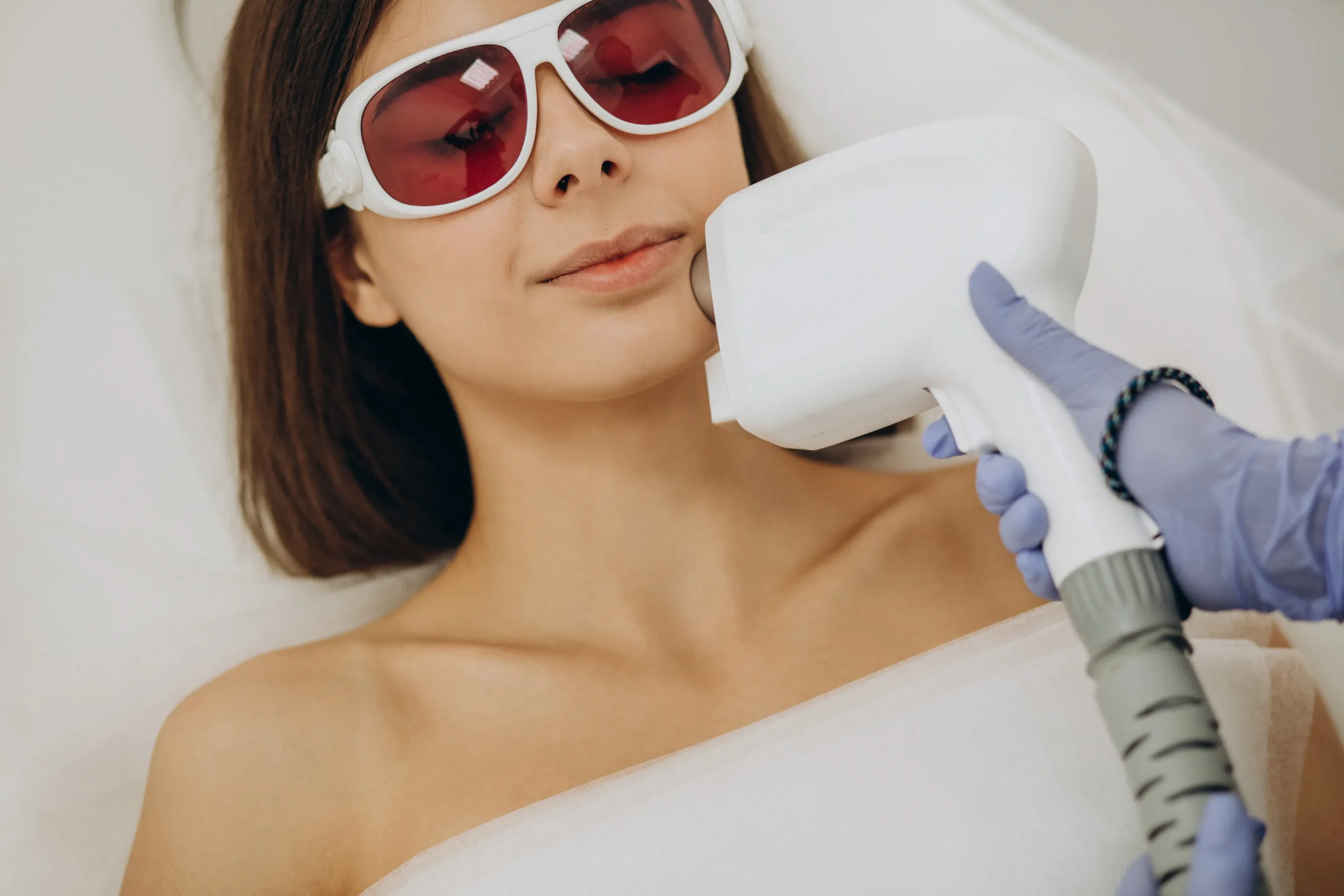 laser-hair-removal-face-treatment Laser hair removal treatment on female face with protective goggles, advanced facial hair reduction procedure at medical spa clinic