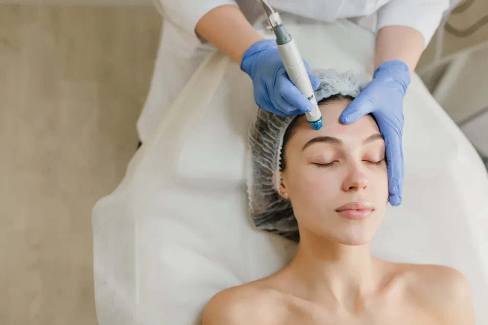 Close-up of a woman receiving advanced microneedling treatment on her forehead by a skincare specialist wearing protective gloves.