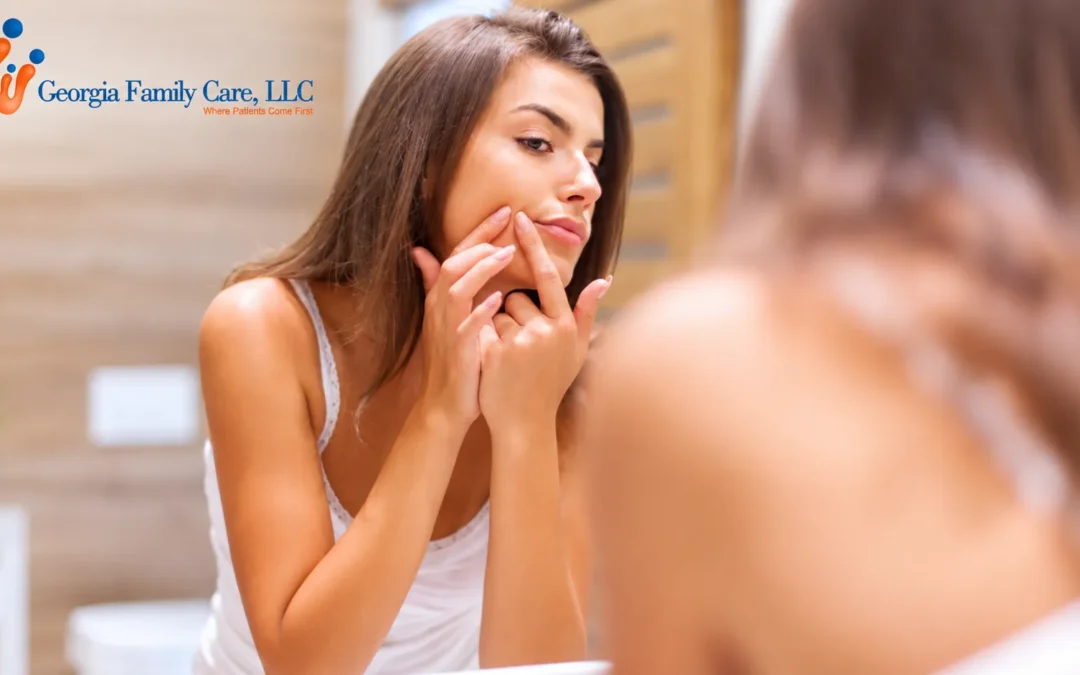 Hormonal Acne Vs Regular Breakouts: 5 Signs It’s Time to See a Doctor